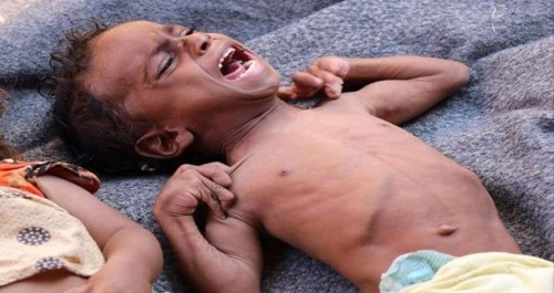 نشطاء تويتر يطلقون هاشتاج  المجاعة بمسيمير لحج