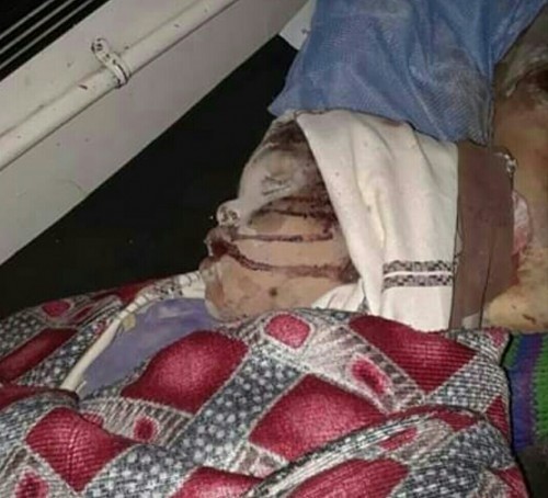 مصرع وإصابة عدة أطفال جراء قصف حوثي بالضالع