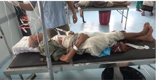 مليشيات الحوثي تستهدف الأحياء السكنية في حيس وتصيب مواطن بجروح (فيديو)