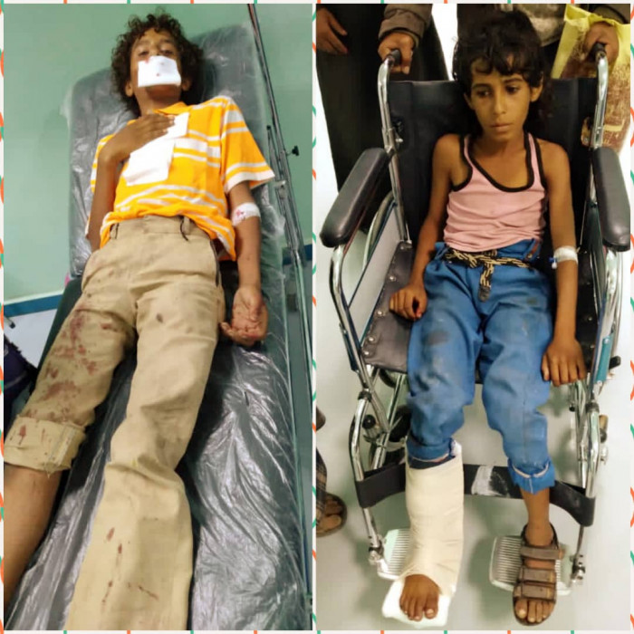 إصابة طفلين بقصف حوثي على شمال الضالع