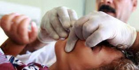 رصد 426 إصابة و33 حالة وفاة بالكوليرا في سوريا