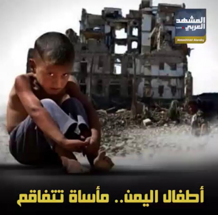 أطفال ⁧‫اليمن‬⁩.. مأساة تتفاقم (فيديوجراف)‫
