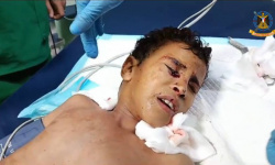 قناص حوثي يصيب طفلا برصاصة في الرأس شمال الضالع