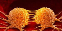 باحثون: تسارع معدلات وفاة مرضى السرطان خلال الفترة الأولى من الجائحة