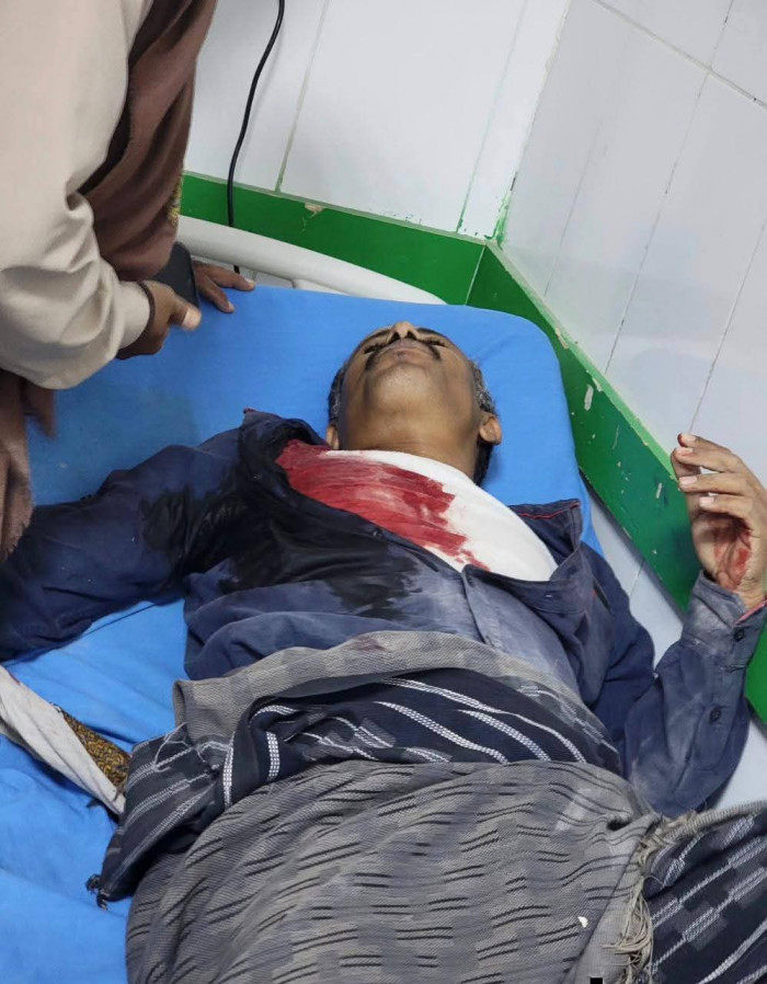 4 شهداء من المتظاهرين بنيران القوات المدعومة سعوديا في شبوة 