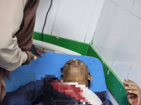 4 شهداء من المتظاهرين بنيران القوات المدعومة سعوديا في شبوة