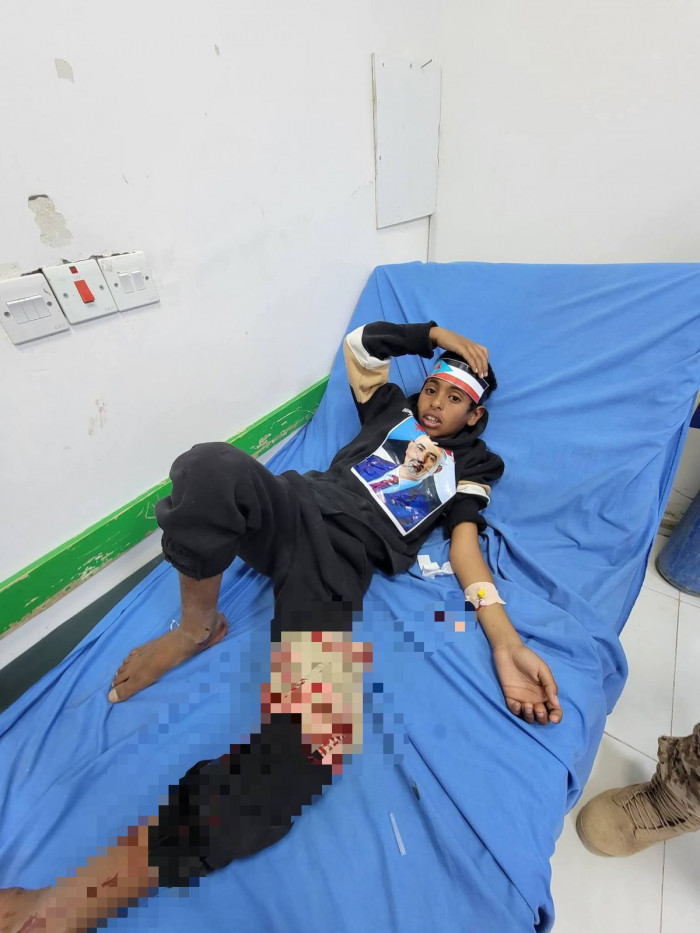 قمع متظاهري عتق في فعالية يوم الشهيد السلمية.. إرهاب يمني برعاية سعودية