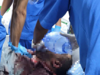 استشهاد المواطن حمزة العولقي بإطلاق نار مباشر في عتق