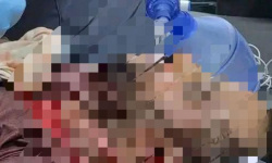 رصاص قوى الاحتلال في عتق يشعل جذوة التحرر الجنوبي