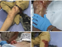 جرحى في إطلاق نار على المتظاهرين أمام معاشيق