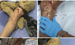 جرحى في إطلاق نار على المتظاهرين أمام معاشيق