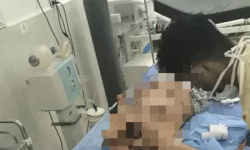 شهيد و20 جريحا حصيلة مجزرة معاشيق بنيران درع الوطن