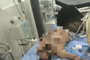 شهيد و20 جريحا حصيلة مجزرة معاشيق بنيران درع الوطن