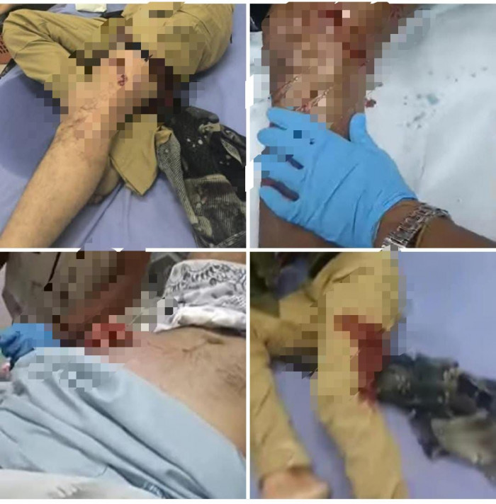 محاولة لتجريم تأييد المجلس الانتقالي.. حقيقة مرة وراء حملات القمع ضد الجنوب