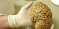 دراسة: شيخوخة الأمعاء تزيد من تدهور القدرات الإدراكية