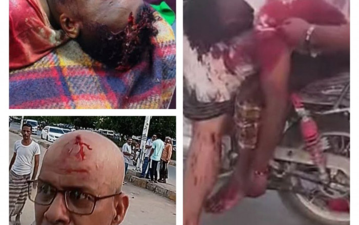 الشبكة المدنية تُدين قمع متظاهري المكلا وتطالب بتحقيق دولي 