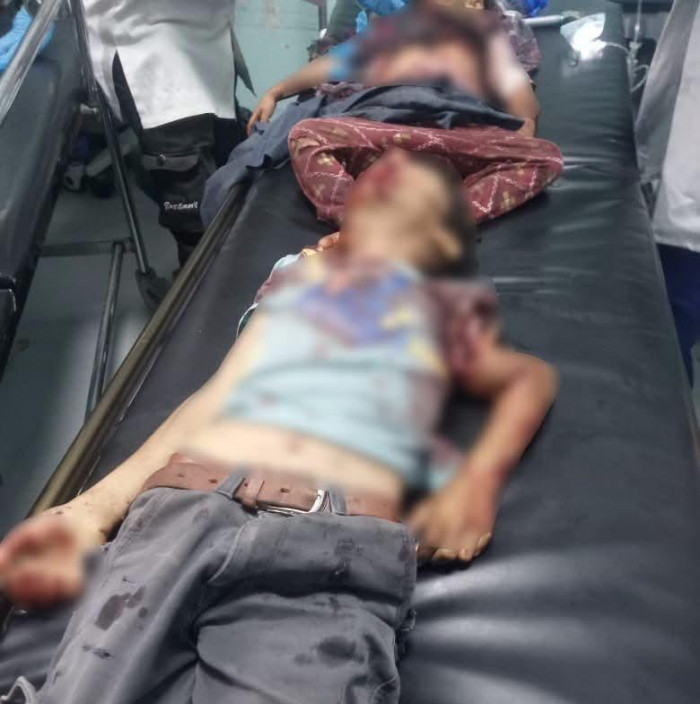 دماء الطفولة في الضالع.. الجنوب يدفع ضريبة الصمود في وجه الإرهاب الحوثي دماء الطفولة في الضالع.. الجنوب يدفع ضريبة الصمود في وجه الإرهاب الحوثي