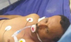 أحد ضحايا القصف السعودي.. استشهاد عبدالرحيم الردفاني بعد غيبوبة لـ8 أشهر