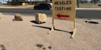 وفاة شخصين بمرض الحصبة في ولاية بنسلفانيا 