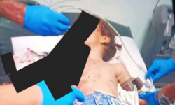إصابة طفلة بجروح إثر انفجار بقايا مقذوف بمديرية الضالع